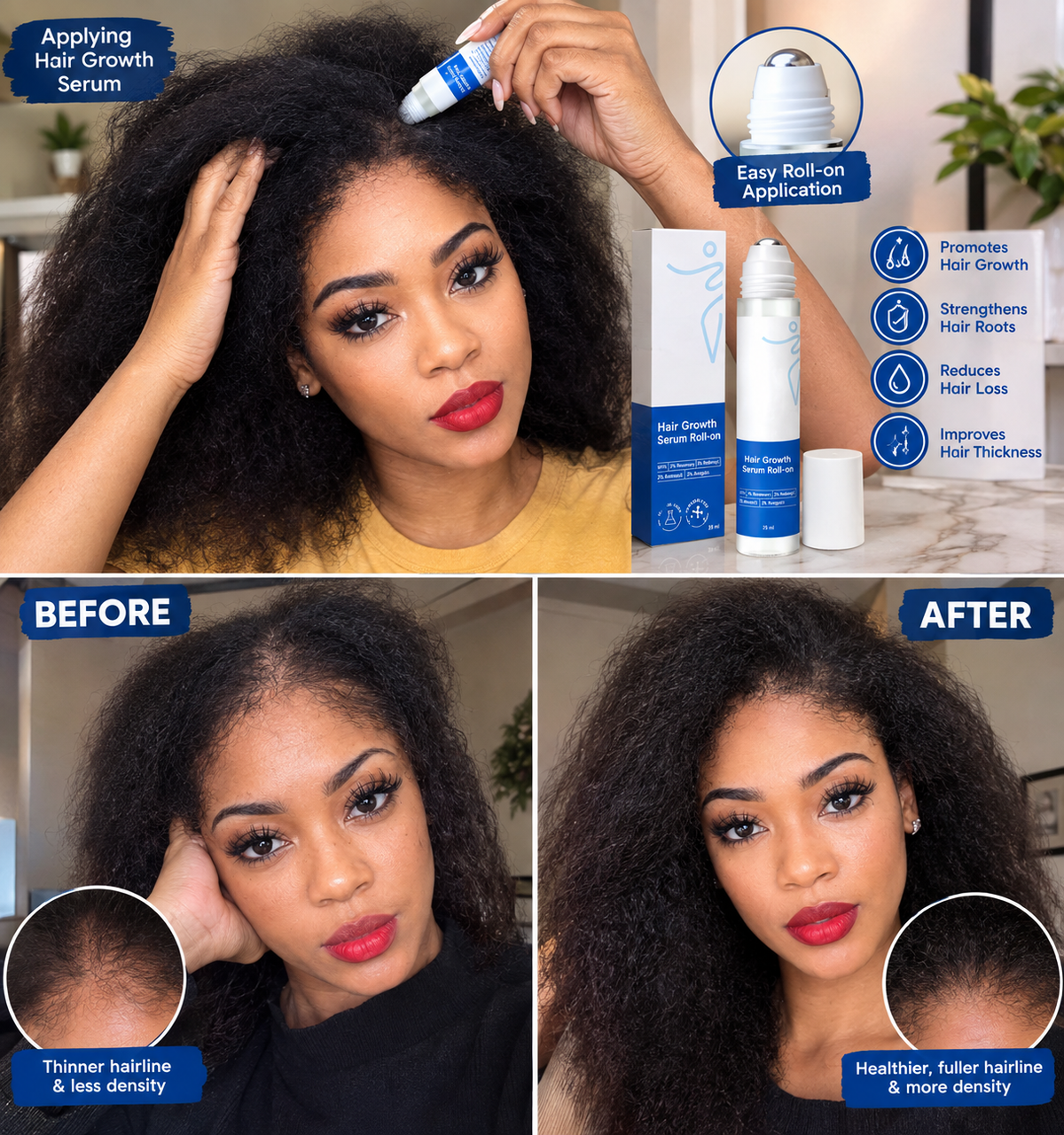 Rosemary Hair Growth Serum UGC before and after